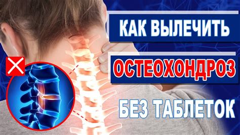 санаторно лечение на остеохондроза в района на Челябинск